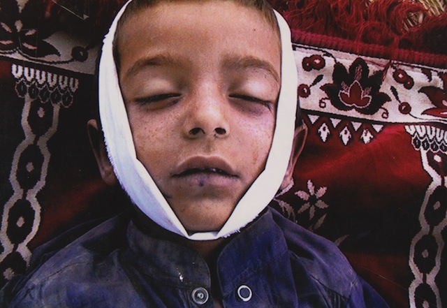 Noor Behram: Syed Wali Shah, 7 años, víctima de un ataque de un dron en Waziristan. Pakistán, 2009